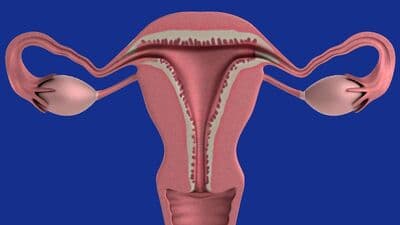 Ovarian Cancer : எச்சரிக்கை பெண்களே! உங்களுக்கு கருப்பை வாய் புற்றுநோய் உள்ளதா என்பதை அறியும் எளிய வழி! 