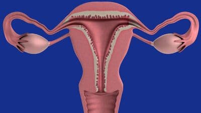 Uterus Problems : மாதத்தில் 5 நாள் மட்டும் இந்த உருண்டை போதும்! பிசிஓடி, பிசிஓஎஸ் என கருப்பை பிரச்னைகளுக்கு தீர்வு!